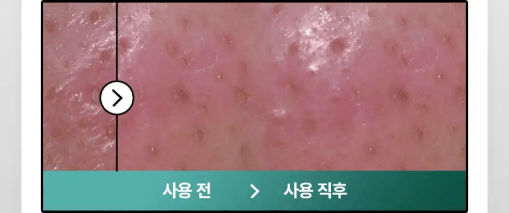 [블랙헤드제거] 야다 그린 티 퓨어 클렌징 밤 100ml 상세페이지 12